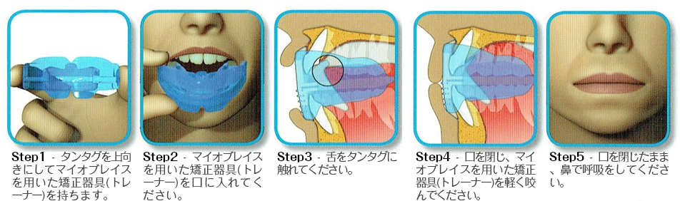 使用方法