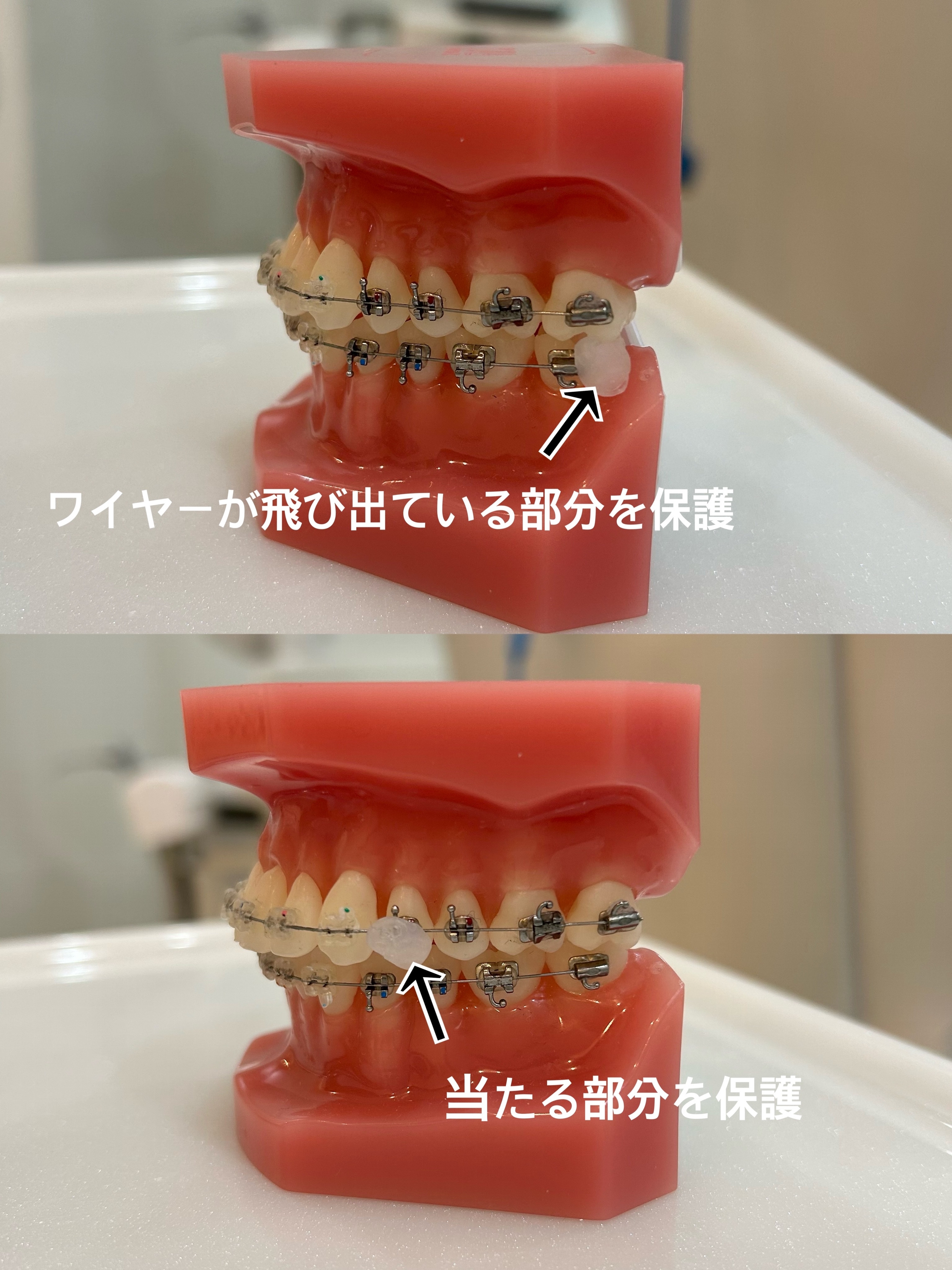 はは