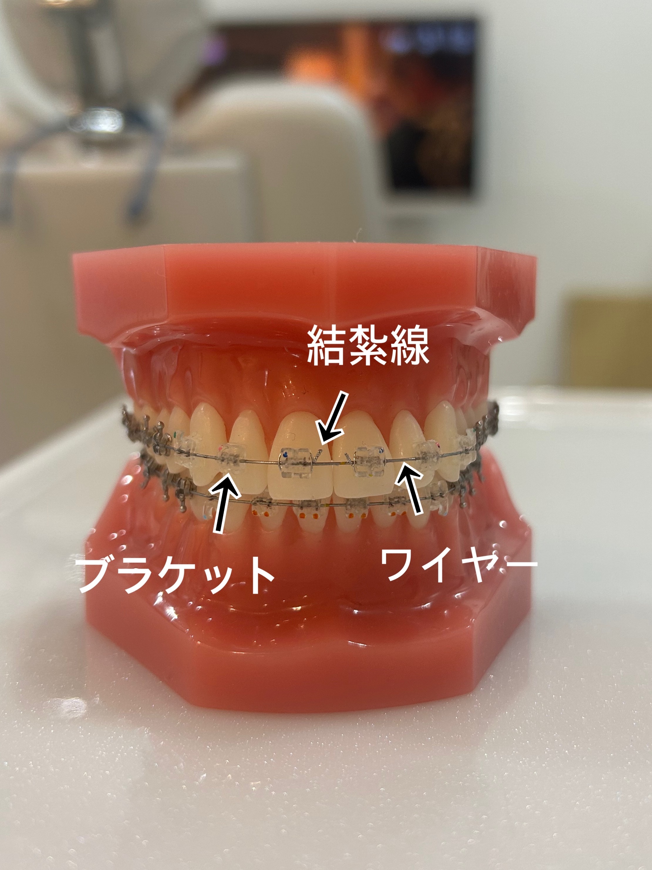 は